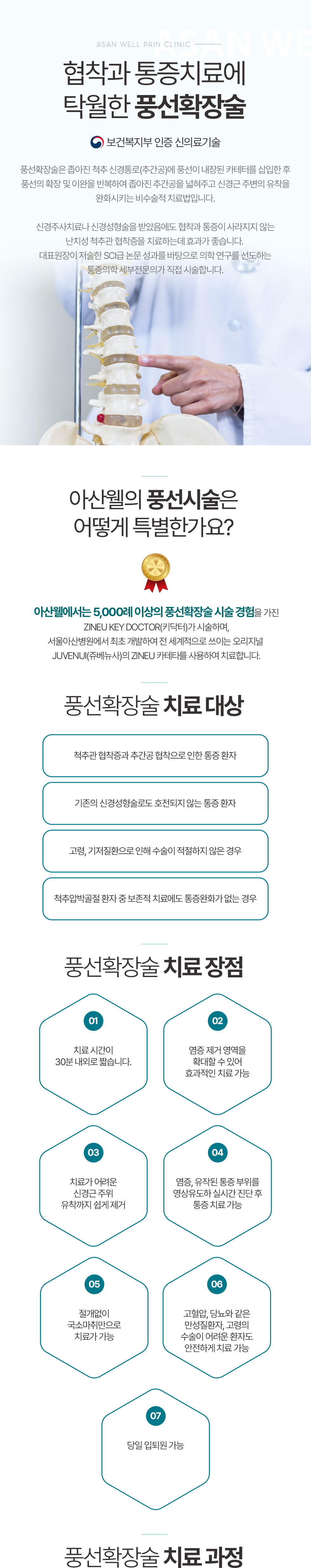 풍선 확장술