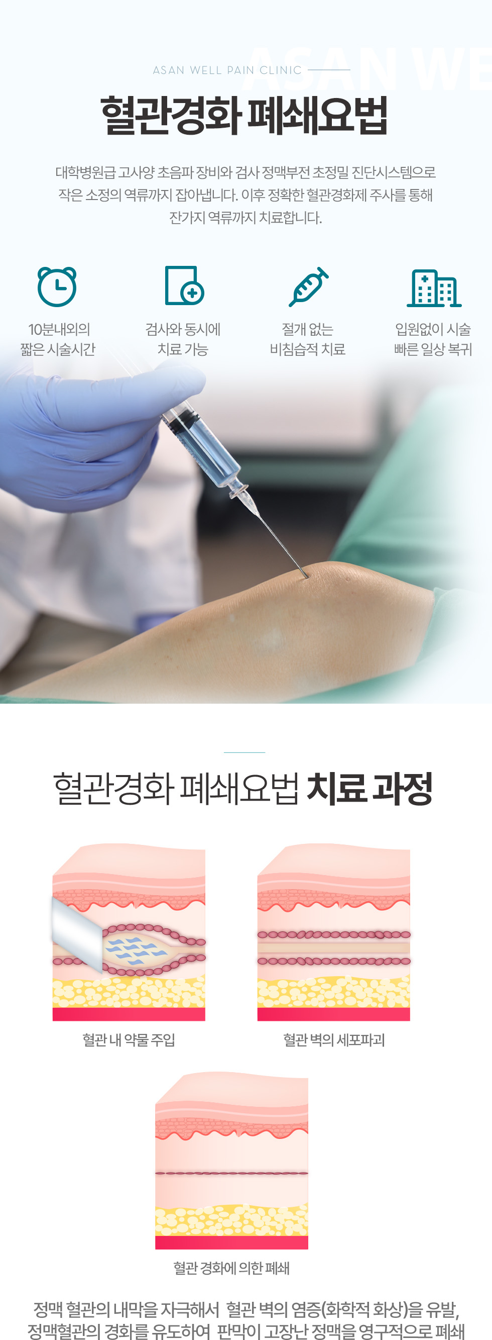 베나실 시술
