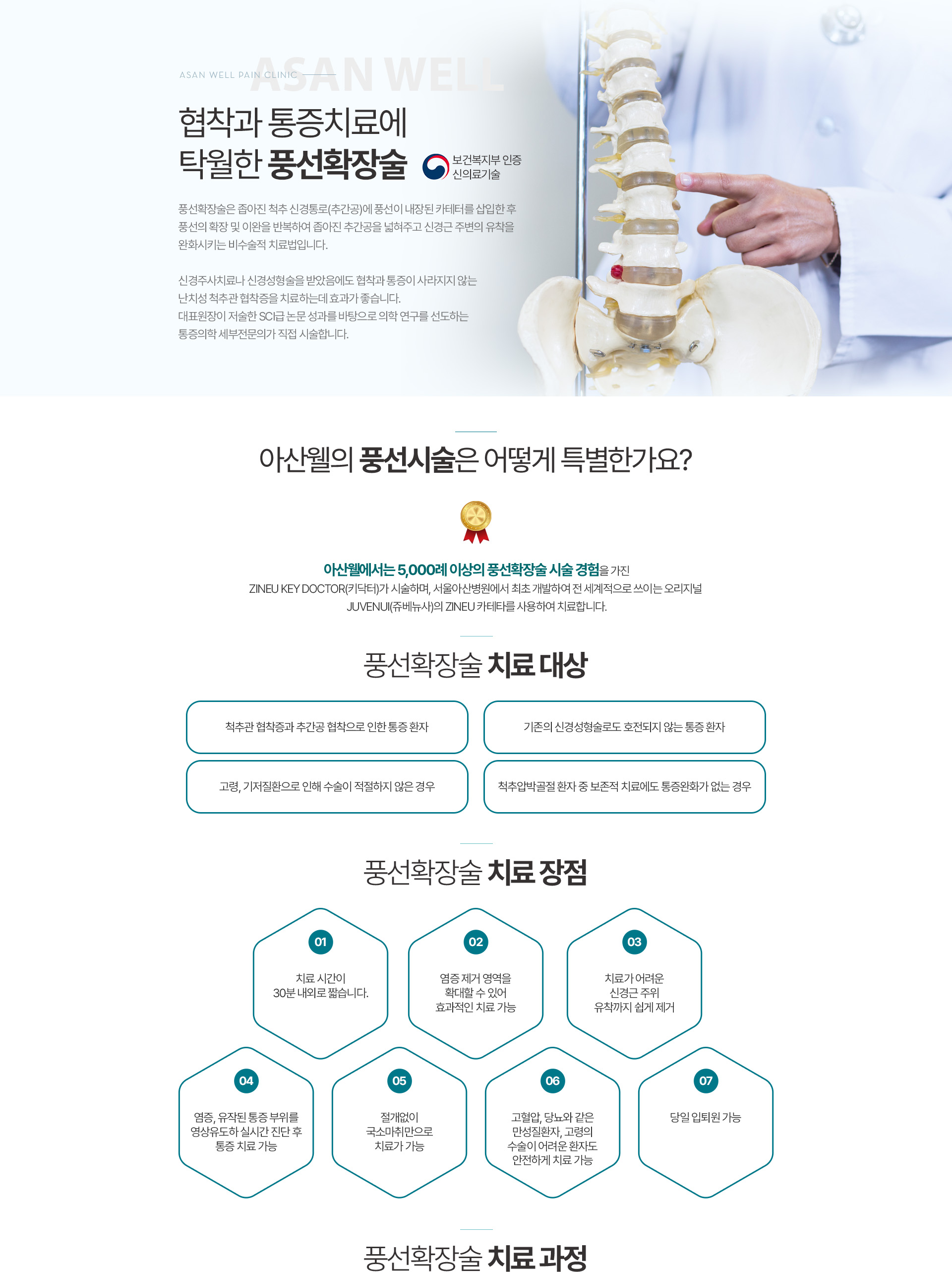 풍선 확장술