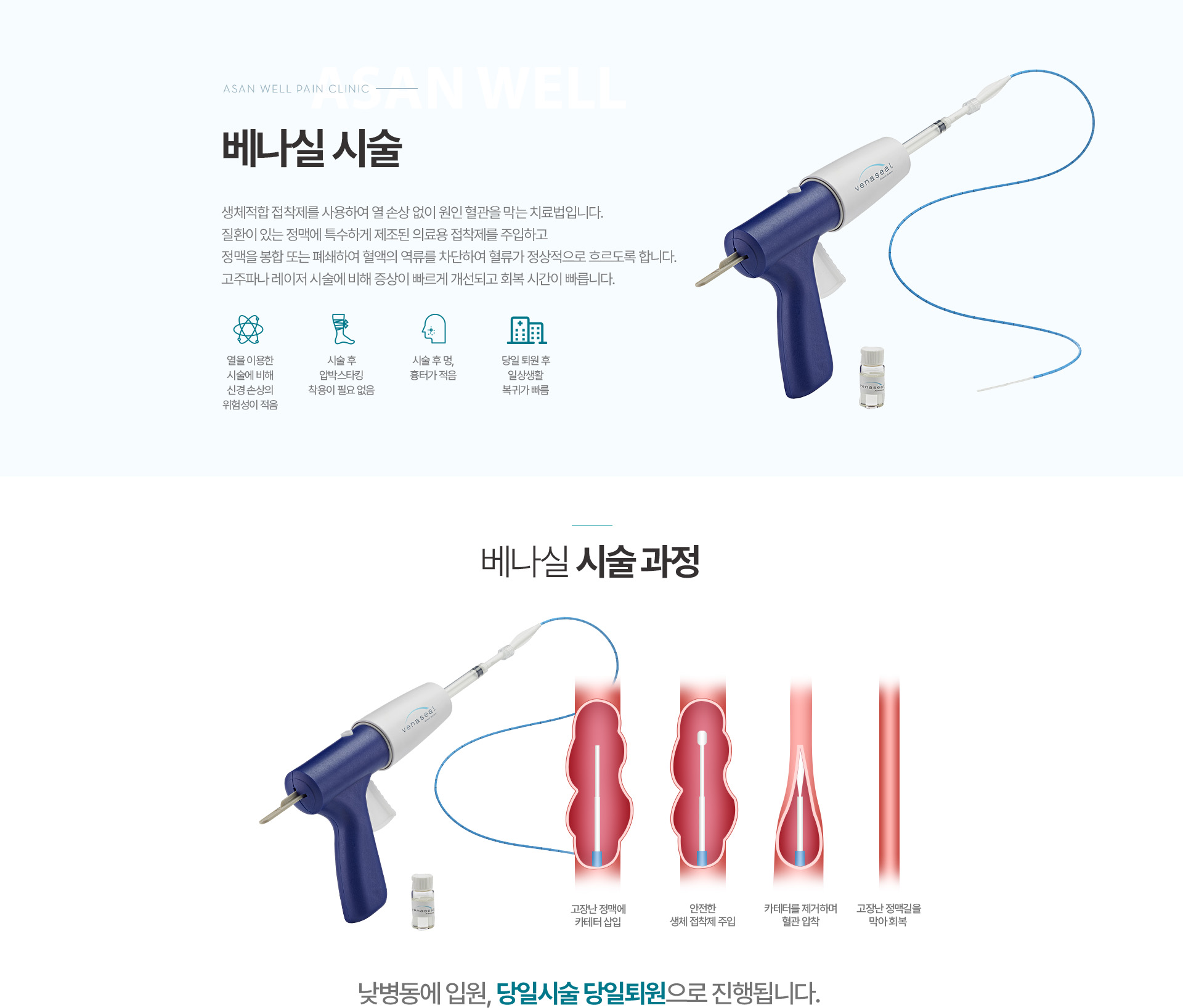 베나실 시술